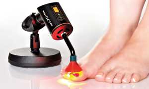 Лечение грибка на ногтях ног с помощью медного купороса: эффективные методы и советы