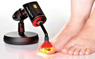 Лечение грибка на ногтях ног с помощью медного купороса: эффективные методы и советы