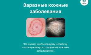 Пути заражения и меры предосторожности от стригущего лишая: важные рекомендации для здоровья