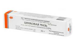 Свойства и преимущества цинковой мази при лечении псориаза: полезные рекомендации