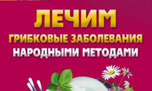 Распространенные народные средства для лечения от грибка ног и кожи