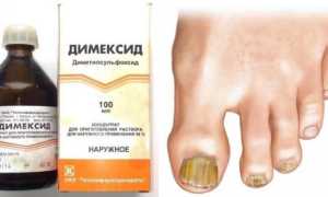 Как правильно применять Димексид против грибка ногтей? Полезные советы и рекомендации.