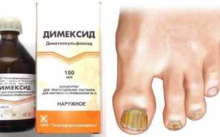 Как правильно применять Димексид против грибка ногтей? Полезные советы и рекомендации.