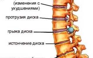 Болит где