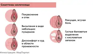Виды и причины неприятных выделений при молочнице: что нужно знать