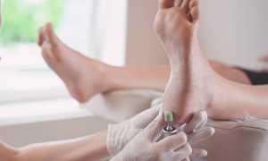 Использование аппаратного педикюра при лечении ногтей от грибка для здоровья и красоты