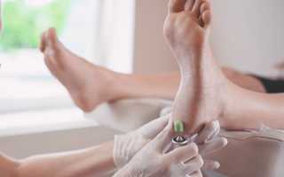 Использование аппаратного педикюра при лечении ногтей от грибка для здоровья и красоты