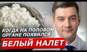 Что делать, если член мужчины поражен грибком? Полезные советы и рекомендации
