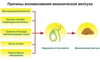 Механическая желтуха что это