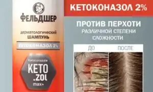 Какой шампунь лучше спасает от грибка кожи: советы и рекомендации