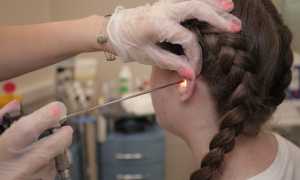 Диагностика грибка в ушах и способы лечения заболеваний уха