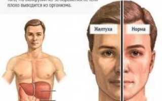 Глаза гепатит