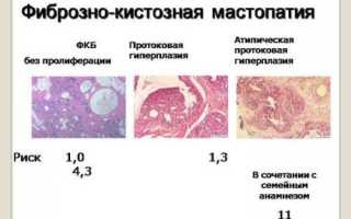 Что такое эхографические признаки