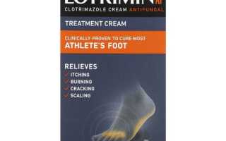 Особенности применения препарата Лотримин для лечения грибка на коже