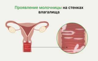 Причины появления грибка в паху у мужчин: важные аспекты здоровья