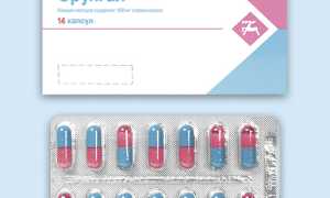 Способы использования средства Орунгал при грибковом заболевании для эффективного лечения