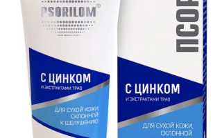 Особенности применения препарата Псорилом в дерматологии