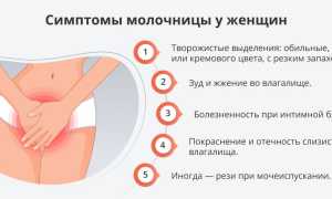 Диагностика и лечение заболевания молочница у женщин: советы и рекомендации