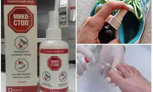 Правильные способы обработки носков и обуви при грибке ногтей для здоровья