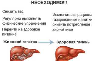 Жировая печень симптомы лечение