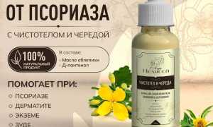 Лечение чистотелом кожного заболевания — псориаз: эффективные методы и рекомендации