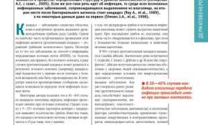 Лечение и диагностика урогенитального кандидоза: важные аспекты и рекомендации