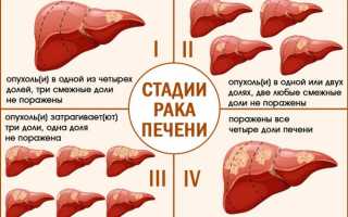 Новообразование в печени что это может быть