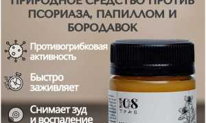 Лечение грибковой инфекции с помощью чистотела: эффективные методы и рекомендации