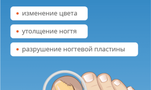 Народные и медикаментозные способы лечения грибка на пальцах ног: советы и рекомендации