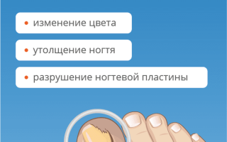 Народные и медикаментозные способы лечения грибка на пальцах ног: советы и рекомендации