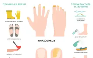 Где и как можно заразиться грибком ногтей: важные советы и рекомендации