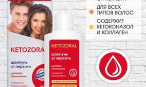 Особенности применения медицинского препарата Кетозорал в терапии