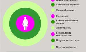 Опасность молочницы для организма человека