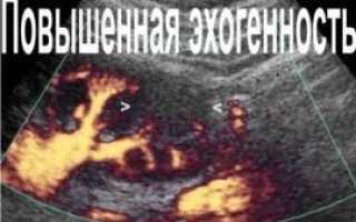 Повышенная эхогенность печени что это такое