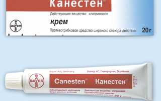Эффективный препарат от грибка — Канестен для здоровья ног