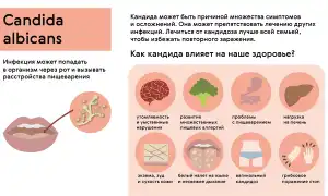 Обострение симптомов молочницы перед менструацией: причины и рекомендации
