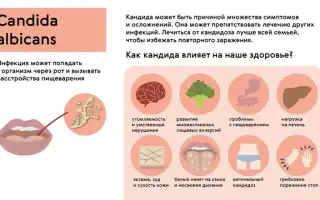 Обострение симптомов молочницы перед менструацией: причины и рекомендации