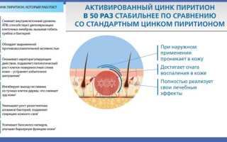 Первые и основные меры при обострении псориаза для эффективного лечения