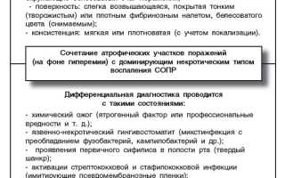 Методы диагностики и анализ на молочницу при кандидозе: важные аспекты