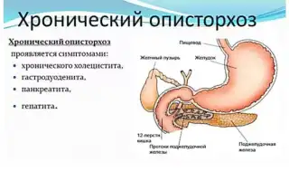 Описторхоз симптомы у человека
