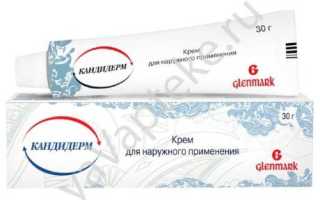 Особенность и способы применения препарата Кандидерм в лечении заболеваний