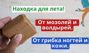Помогает ли хозяйственное мыло от грибка ногтей? Узнайте мнение экспертов