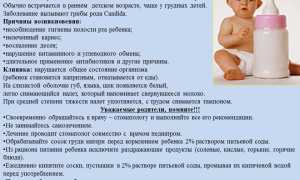 Профилактика и лечение молочницы на губах у ребенка: советы и рекомендации