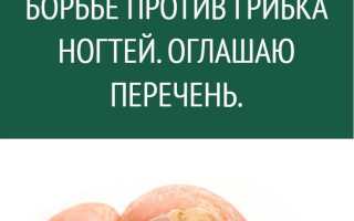 Какие эффективные народные рецепты существуют для лечения грибка ногтей в домашних условиях?