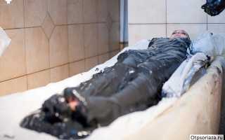 Лечение псориаза в санаториях России