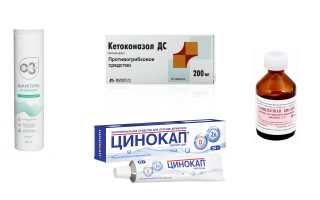 Лечение препаратами и народными средствами жирной себореи кожи лица: советы и рекомендации