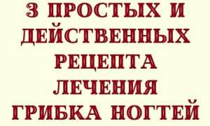 Советы по лечению грибка на ногтях ног при помощи полыни для здоровья