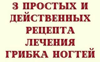 Советы по лечению грибка на ногтях ног при помощи полыни для здоровья