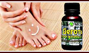Лечение грибка ногтей березовым дегтем в домашних условиях