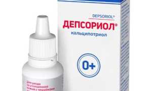 Быстрое избавление от псориаза на голове при помощи лосьона: эффективные методы и советы